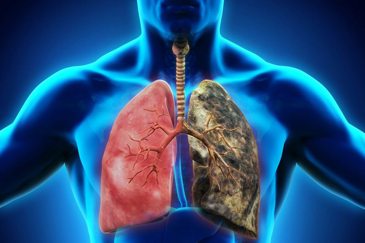 respiratory-medicine